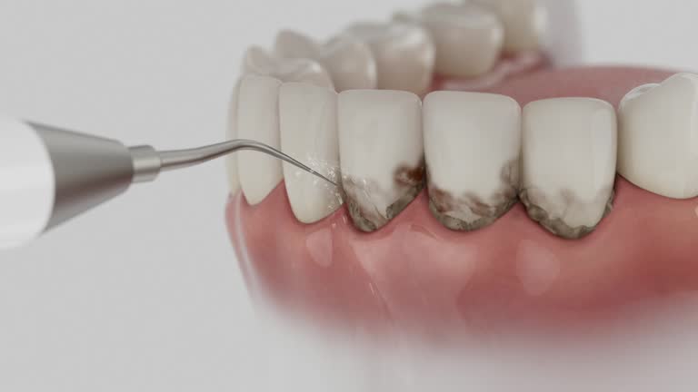 Reliable Dental Implants contractor in Jemison, AL by Smile Center Dentistry